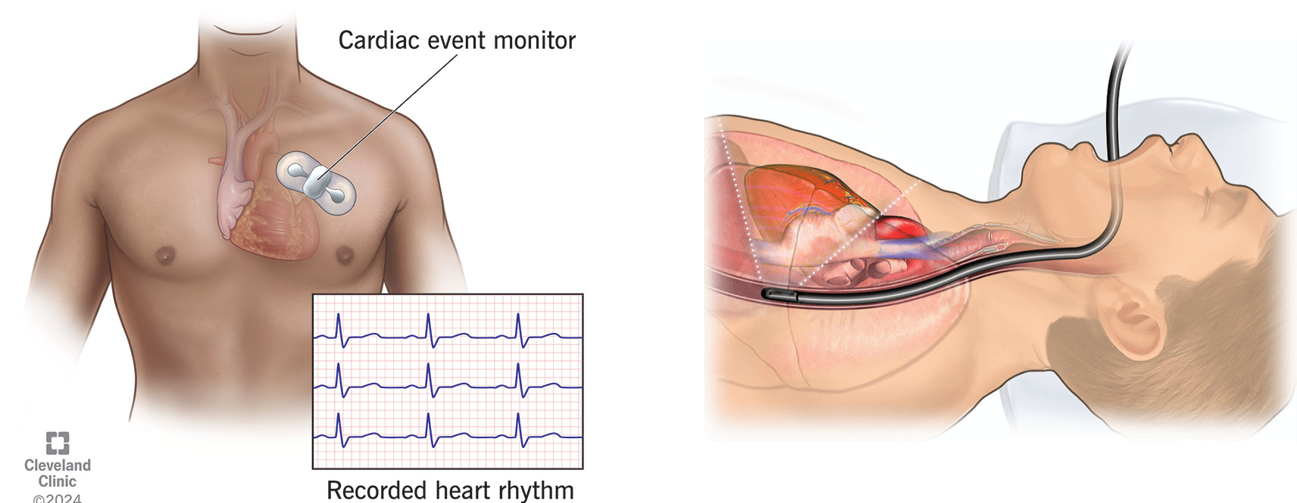 figure2